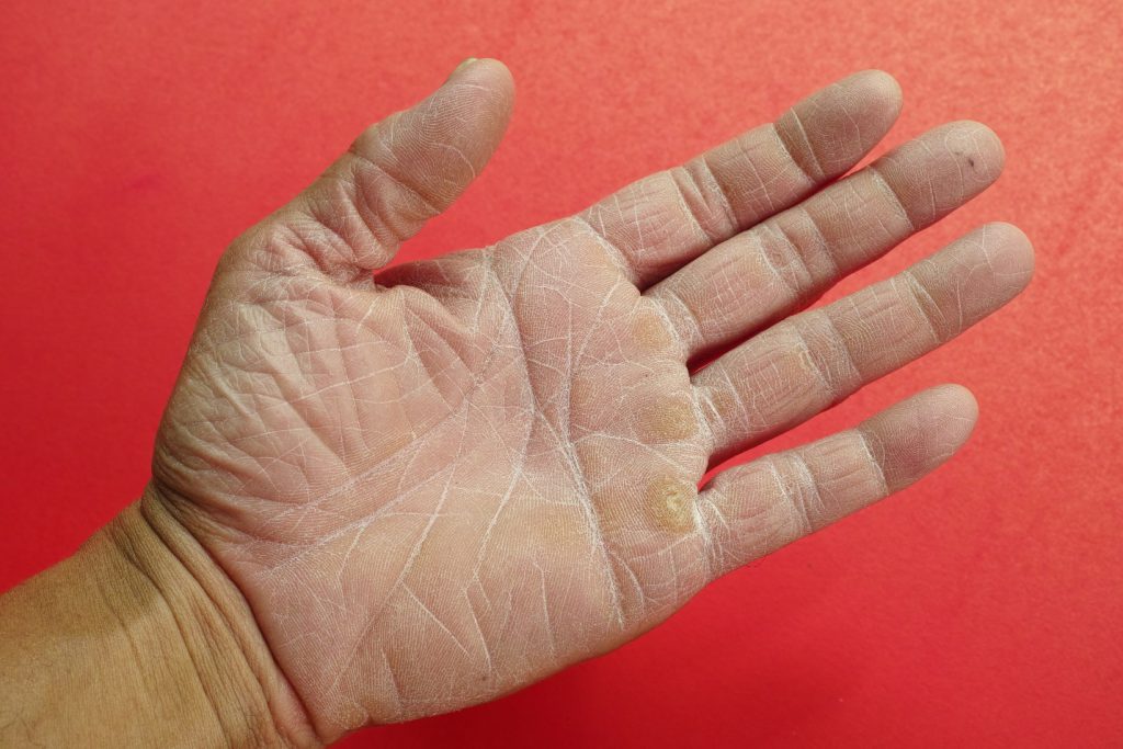 <h1><!-- google_ad_section_start -->Hand Care 101: 3 Helpful Tips for Dealing with Dry Skin on Hands<!-- google_ad_section_end --></h1>